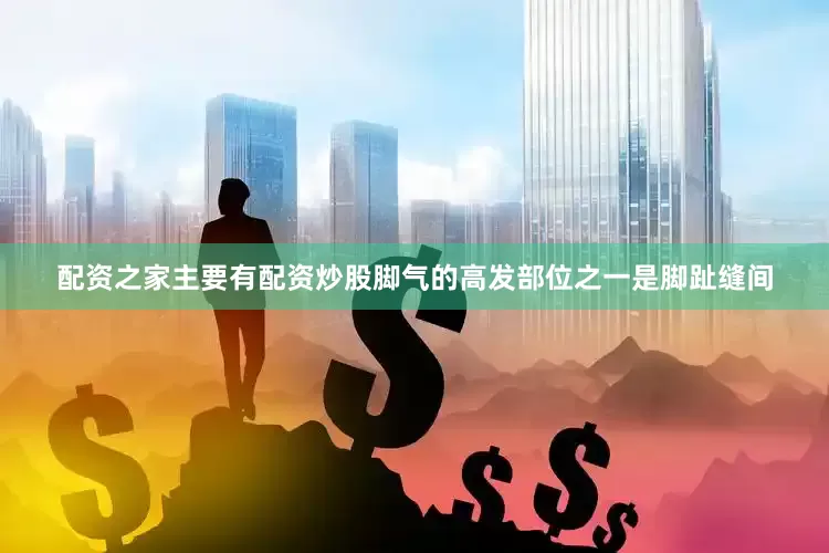 配资之家主要有配资炒股脚气的高发部位之一是脚趾缝间